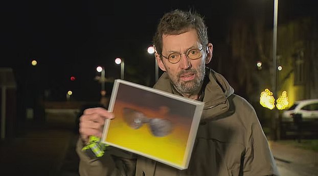 Overlæge og professor Jens Lauritsen viser et billede af afsvedne sikkerhedsbriller, der beskyttede en dreng, som oplevede at få kastet et heksehyl efter sig.
